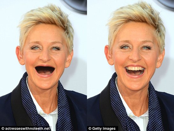 
	
	Trông Ellen khá già nua khi không có răng nữa.